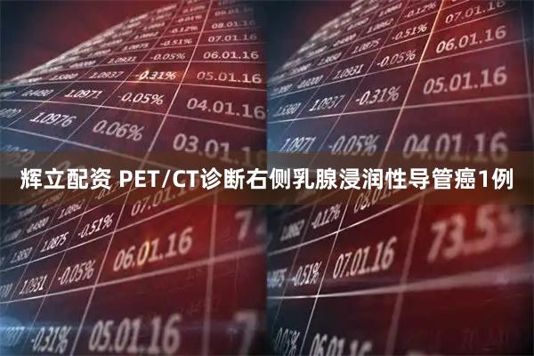 辉立配资 PET/CT诊断右侧乳腺浸润性导管癌1例